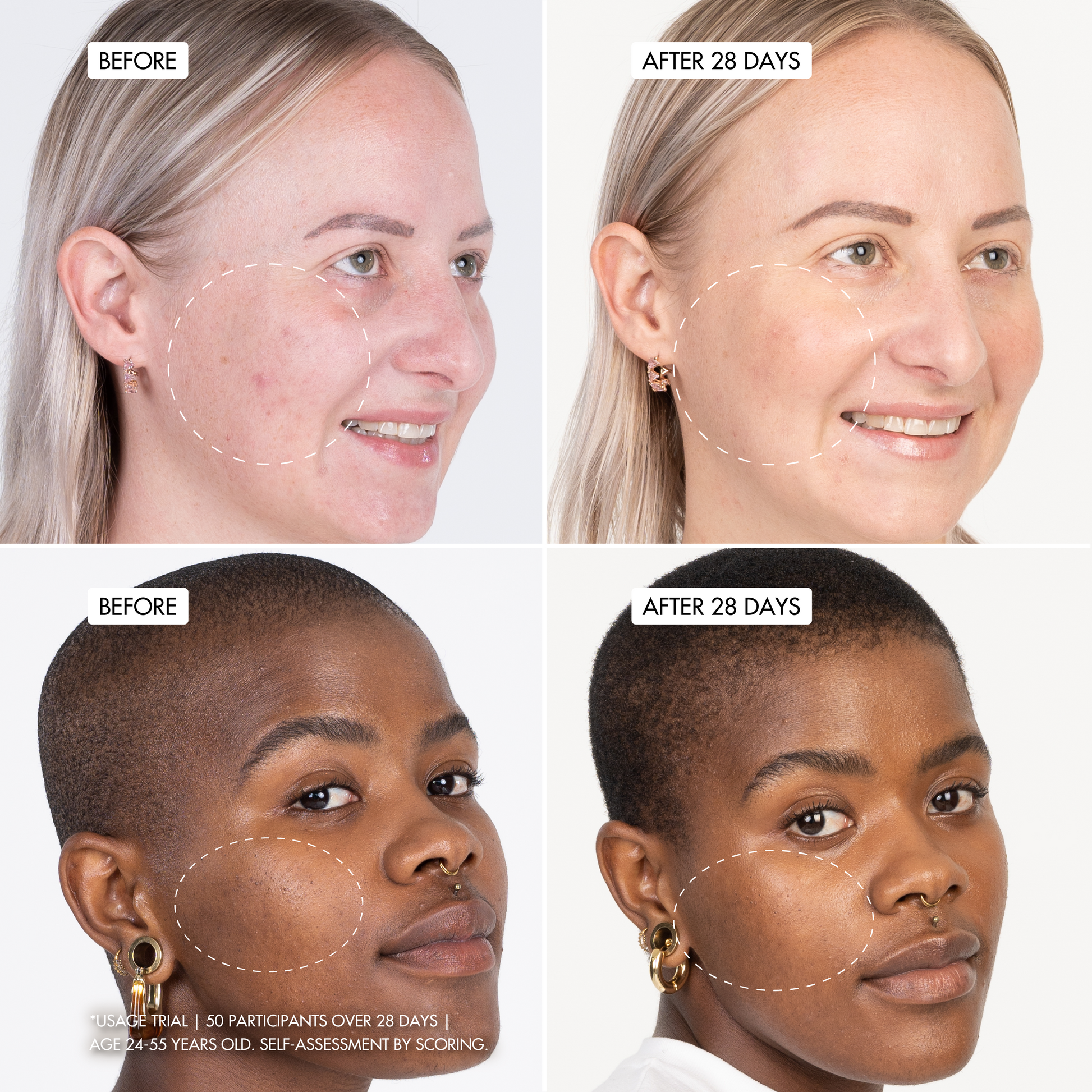 B3 BARRIER REPAIR NanoPillow Serum
user trial before and after images