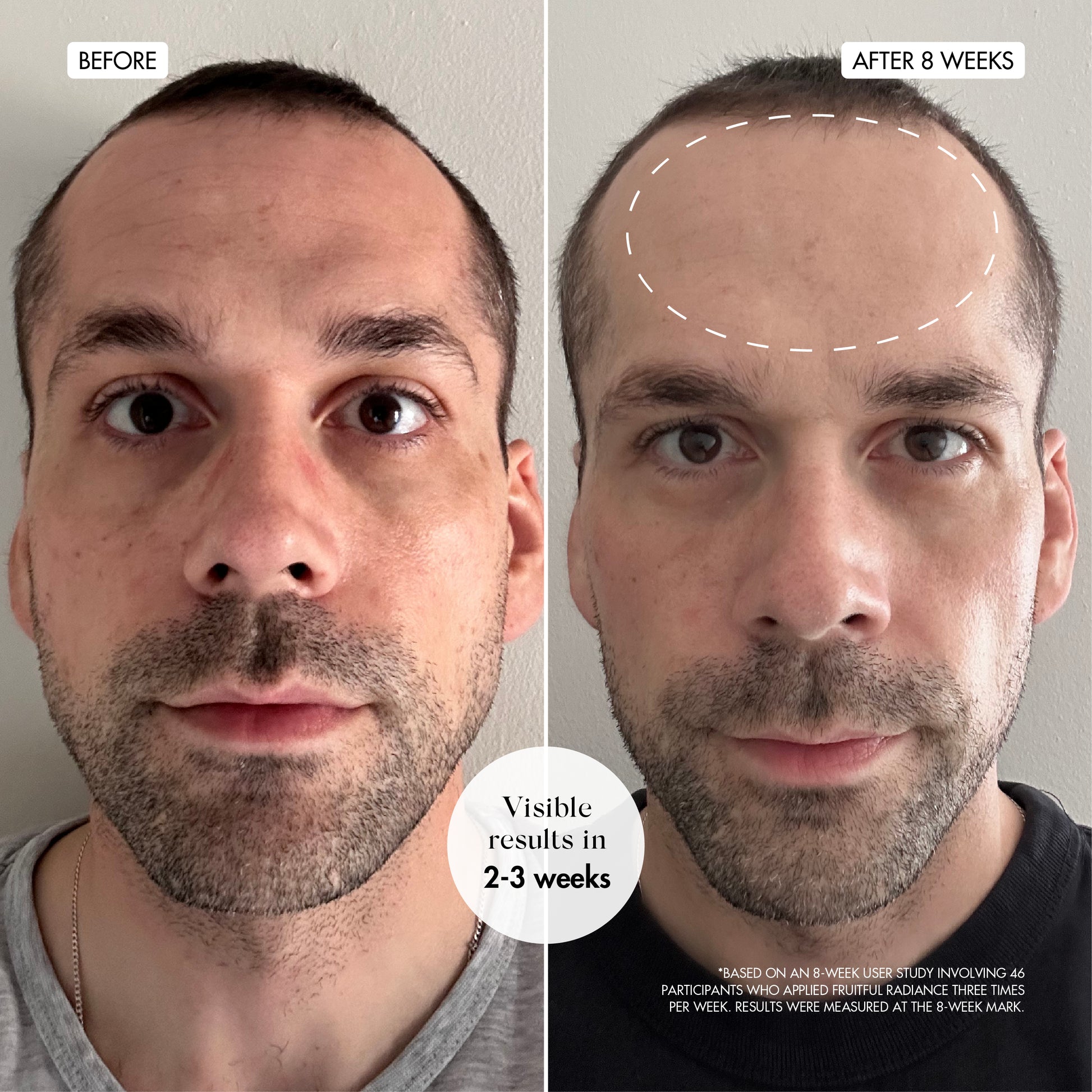 Fruitful Radiance Before & After 01