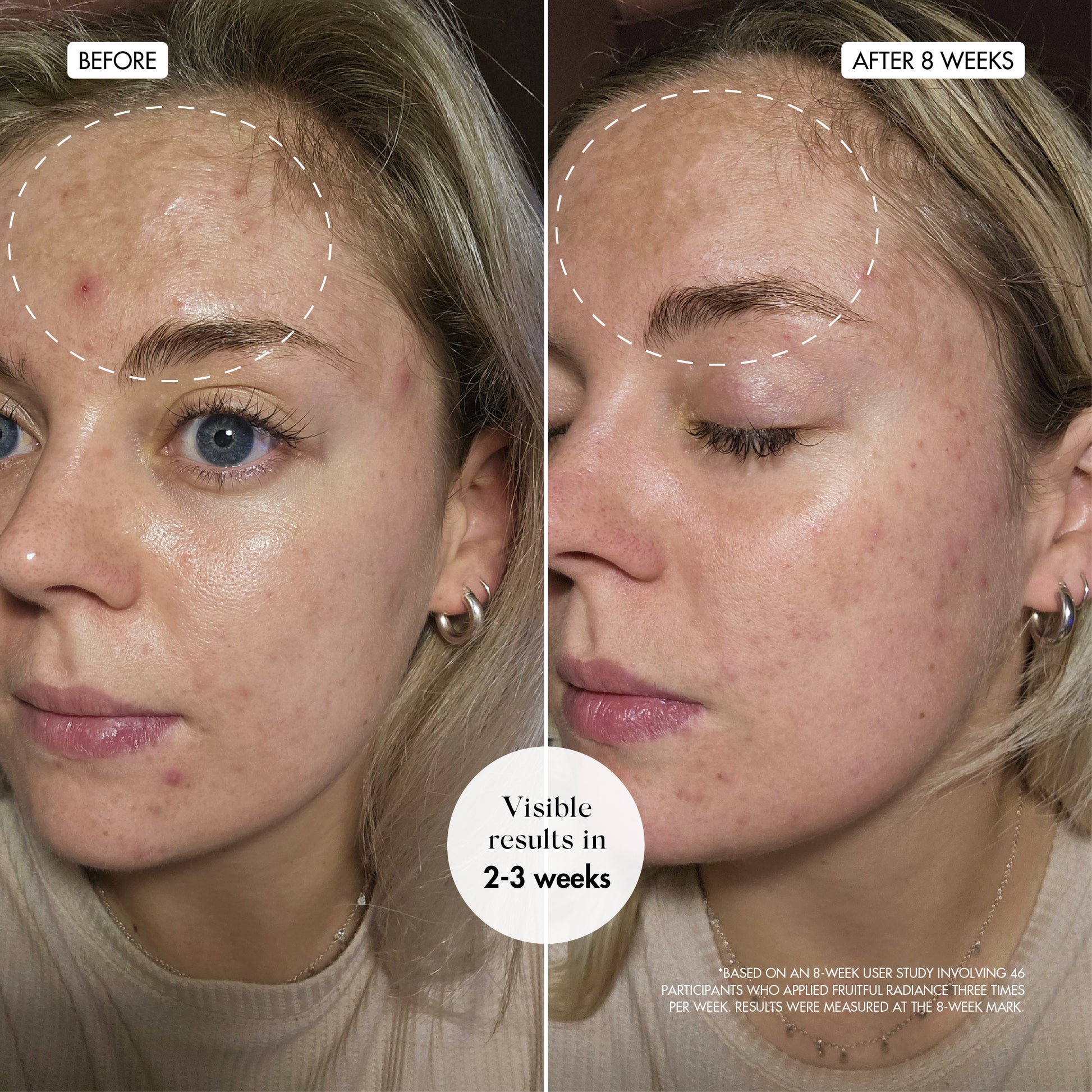 Fruitful Radiance Before & After 03