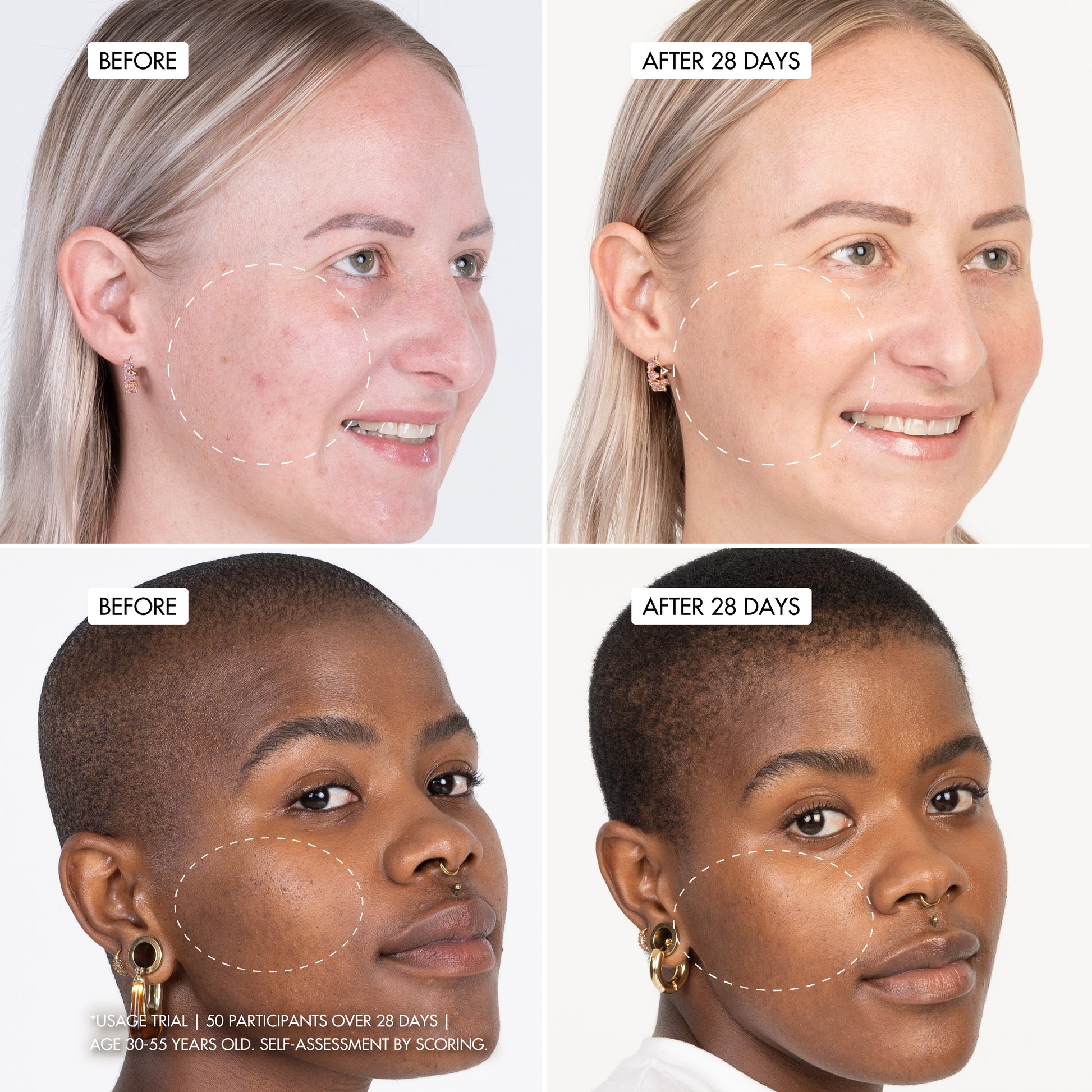 HYDROSURGE Pro-Collagen NanoPillow Serum user trials before and after