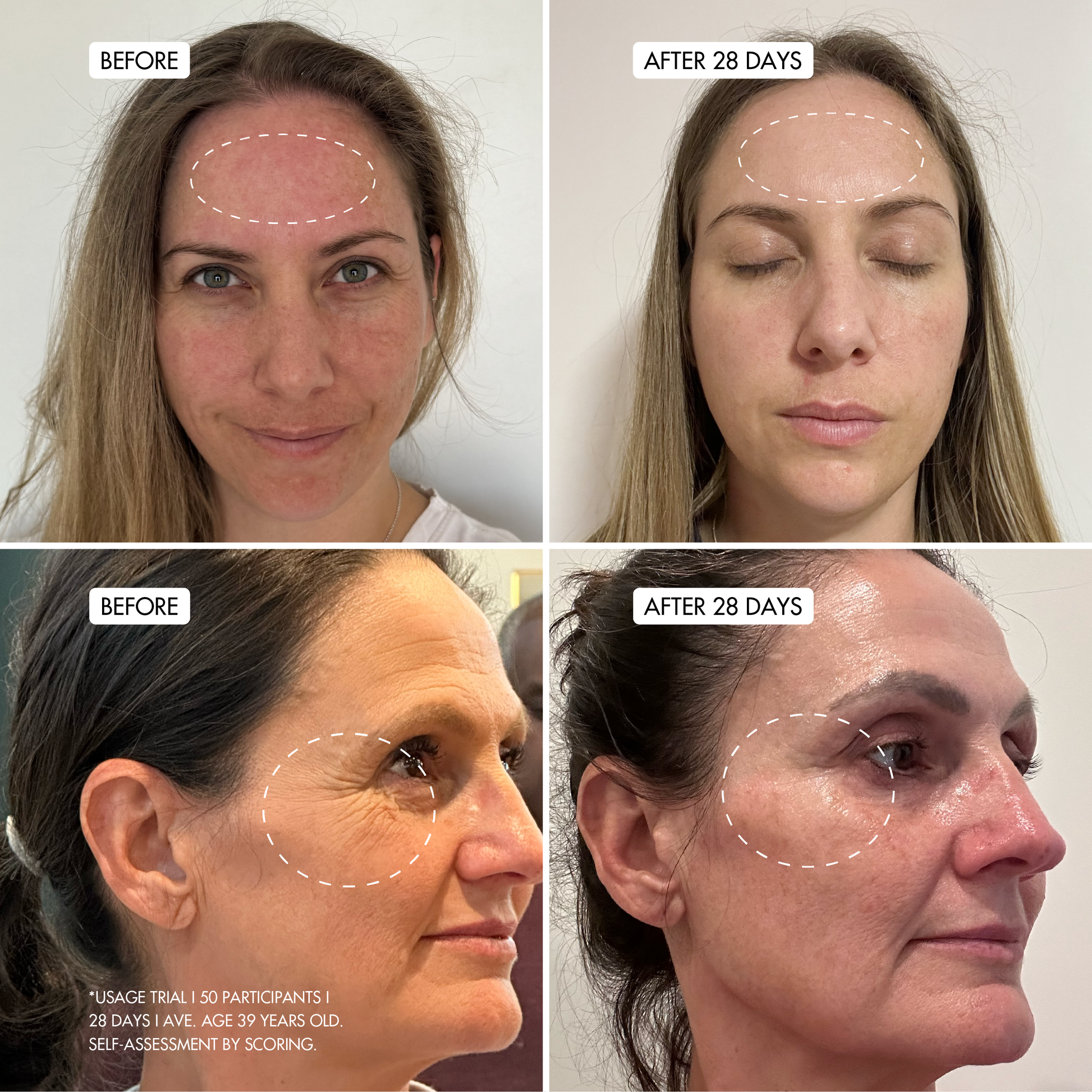 RUBY MARINE Barrier Recovery Face Balm user images of before and after using for 28 days