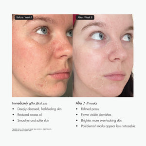 OH SHERBET! 3-in-1 Pore-Refining Exfoliating Mask