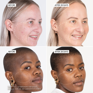 B3 BARRIER REPAIR NanoPillow Serum
user trial before and after images