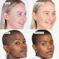 B3 BARRIER REPAIR NanoPillow Serum
user trial before and after images