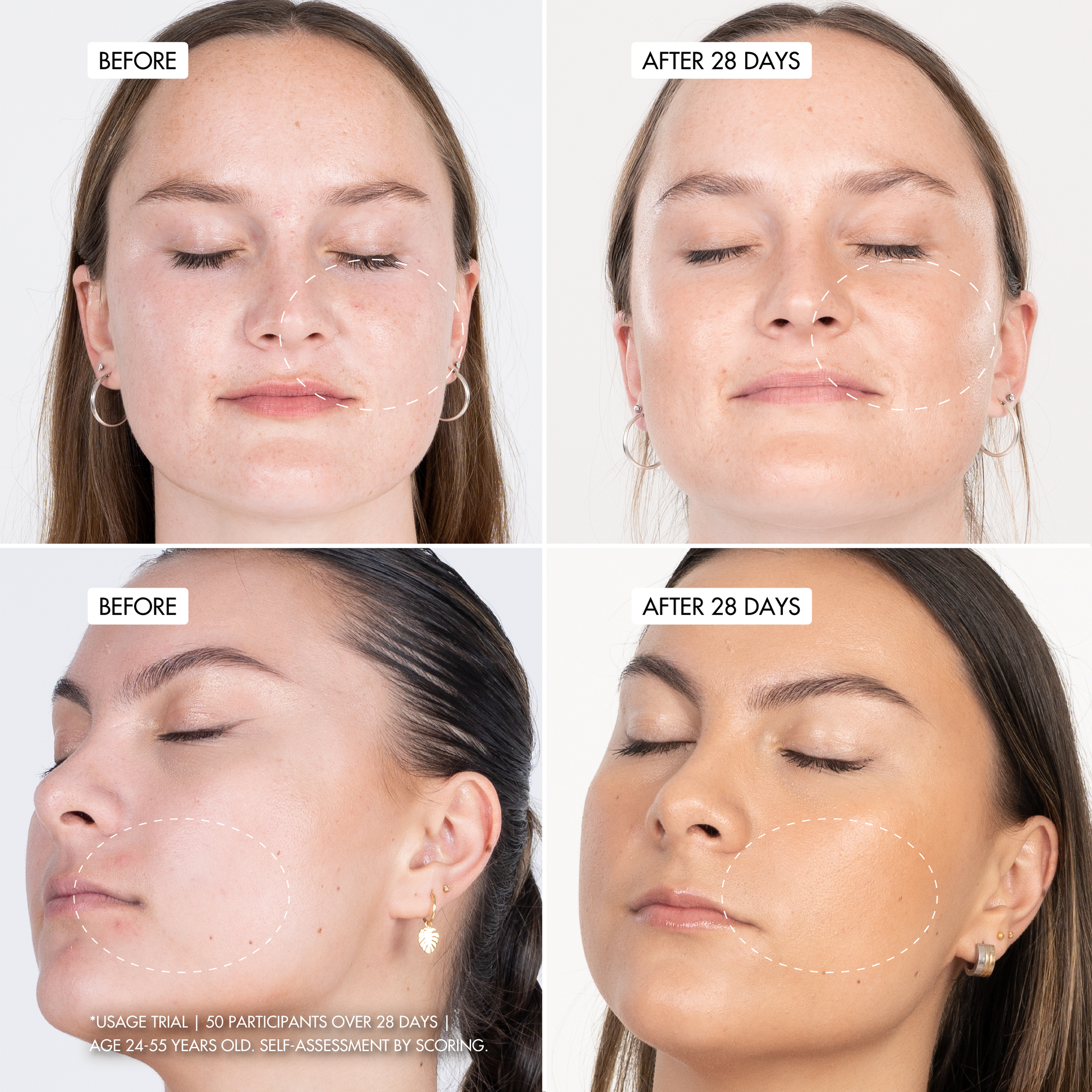 B3 BARRIER REPAIR NanoPillow Serum
user trial before and after images