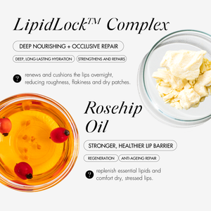 SOENTJIES® Overnight Repair Lip Mask