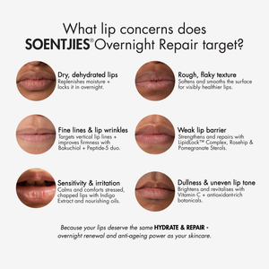 SOENTJIES® Overnight Repair Lip Mask