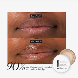 SOENTJIES® Overnight Repair Lip Mask