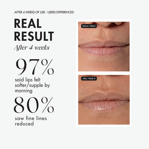 SOENTJIES® Overnight Repair Lip Mask